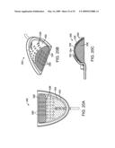 METHODS AND SYSTEMS FOR SALIVA MANAGEMENT WITH AN ORAL DEVICE diagram and image