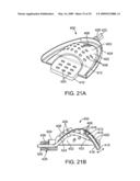 METHODS AND SYSTEMS FOR SALIVA MANAGEMENT WITH AN ORAL DEVICE diagram and image