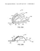 METHODS AND SYSTEMS FOR SALIVA MANAGEMENT WITH AN ORAL DEVICE diagram and image