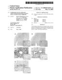 Suppression of inflammation associated with transplantation using an epsilon PKC inhibitor diagram and image