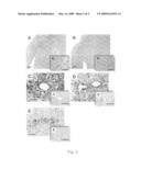 Suppression of inflammation associated with transplantation using an epsilon PKC inhibitor diagram and image