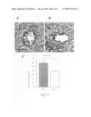 Suppression of inflammation associated with transplantation using an epsilon PKC inhibitor diagram and image