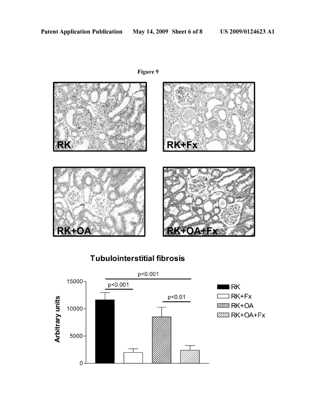 METHODS FOR PRESERVING AND/OR INCREASING RENAL FUNCTION USING XANTHINE OXIDOREDUCTASE INHIBITORS - diagram, schematic, and image 07