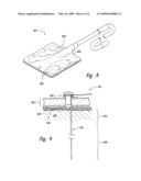 Receptacles for Implanted Device Control Magnets, and Associated Systems and Methods diagram and image