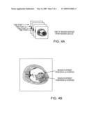 METHOD AND APPARATUS FOR QUANTIFYING THE BEHAVIOR OF AN ADMINISTERED CONTRAST AGENT diagram and image