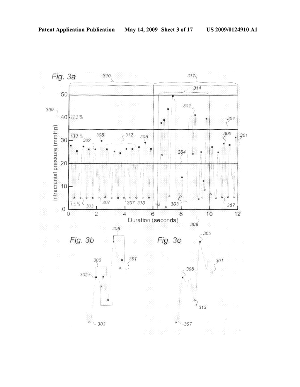 Method for processing of continuous pressure-related signals derivable from a human or animal body or body-cavity - diagram, schematic, and image 04