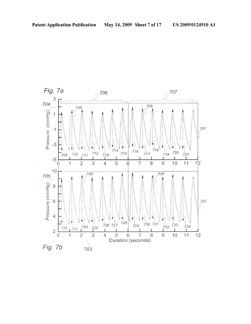 Method for processing of continuous pressure-related signals derivable from a human or animal body or body-cavity - diagram, schematic, and image 08