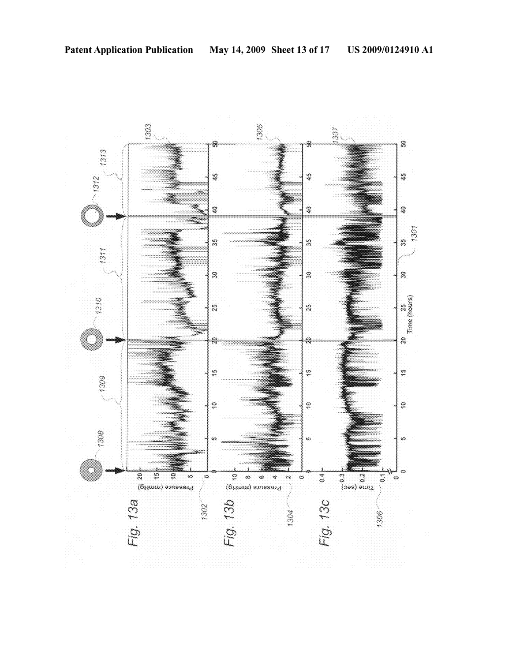 Method for processing of continuous pressure-related signals derivable from a human or animal body or body-cavity - diagram, schematic, and image 14