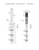 Self-Orientating Bifurcate Catheter diagram and image