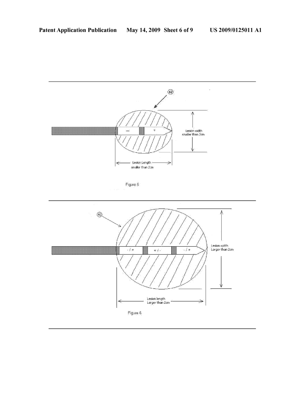 Devices, Methods and Kits for Substantial and Uniform Ablation about a Linear Bipolar Array of Electrodes - diagram, schematic, and image 07