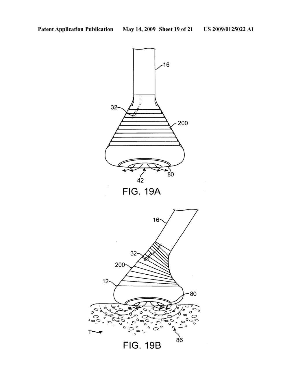 TISSUE VISUALIZATION AND ABLATION SYSTEMS - diagram, schematic, and image 20