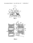 DEVICES AND METHODS FOR SELECTIVE SURGICAL REMOVAL OF TISSUE diagram and image