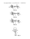 DEVICES AND METHODS FOR SELECTIVE SURGICAL REMOVAL OF TISSUE diagram and image