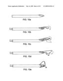 DEVICES AND METHODS FOR SELECTIVE SURGICAL REMOVAL OF TISSUE diagram and image