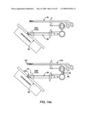 DEVICES AND METHODS FOR SELECTIVE SURGICAL REMOVAL OF TISSUE diagram and image