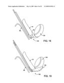 DEVICES AND METHODS FOR SELECTIVE SURGICAL REMOVAL OF TISSUE diagram and image