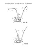 DEVICES AND METHODS FOR SELECTIVE SURGICAL REMOVAL OF TISSUE diagram and image