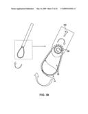 DEVICES AND METHODS FOR SELECTIVE SURGICAL REMOVAL OF TISSUE diagram and image