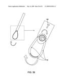 DEVICES AND METHODS FOR SELECTIVE SURGICAL REMOVAL OF TISSUE diagram and image