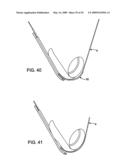 DEVICES AND METHODS FOR SELECTIVE SURGICAL REMOVAL OF TISSUE diagram and image