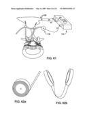 DEVICES AND METHODS FOR SELECTIVE SURGICAL REMOVAL OF TISSUE diagram and image