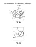 DEVICES AND METHODS FOR SELECTIVE SURGICAL REMOVAL OF TISSUE diagram and image