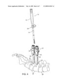 Tissue splitter diagram and image