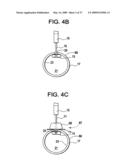 SYSTEMS AND METHODS FOR PUNCTURE CLOSURE diagram and image