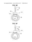 SYSTEMS AND METHODS FOR PUNCTURE CLOSURE diagram and image