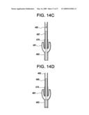 SYSTEMS AND METHODS FOR PUNCTURE CLOSURE diagram and image