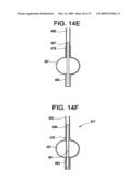 SYSTEMS AND METHODS FOR PUNCTURE CLOSURE diagram and image