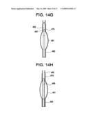 SYSTEMS AND METHODS FOR PUNCTURE CLOSURE diagram and image