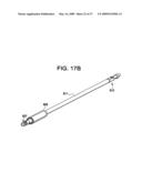 SYSTEMS AND METHODS FOR PUNCTURE CLOSURE diagram and image