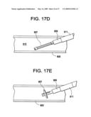 SYSTEMS AND METHODS FOR PUNCTURE CLOSURE diagram and image