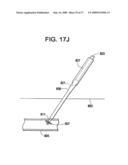 SYSTEMS AND METHODS FOR PUNCTURE CLOSURE diagram and image