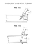 SYSTEMS AND METHODS FOR PUNCTURE CLOSURE diagram and image