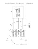 SYSTEM FOR NEURAL THERAPY diagram and image