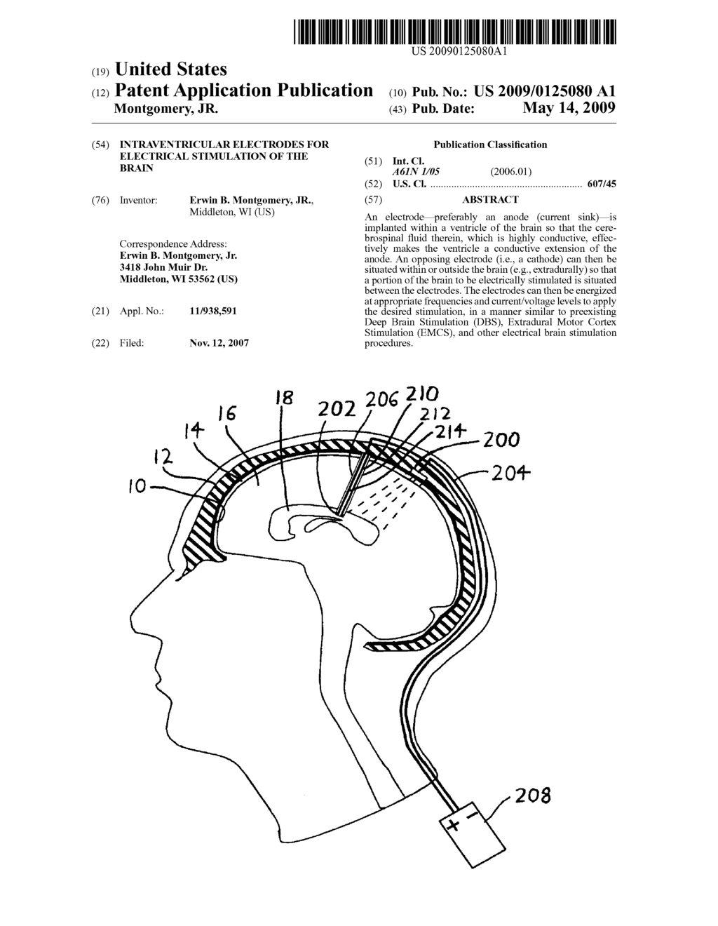 INTRAVENTRICULAR ELECTRODES FOR ELECTRICAL STIMULATION OF THE BRAIN - diagram, schematic, and image 01