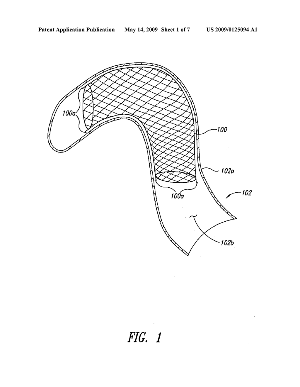 SHEATH FOR INTRAVASCULAR INFLATABLE STRUCTURES, FOR EXAMPLE TO EXPAND STENTS - diagram, schematic, and image 02