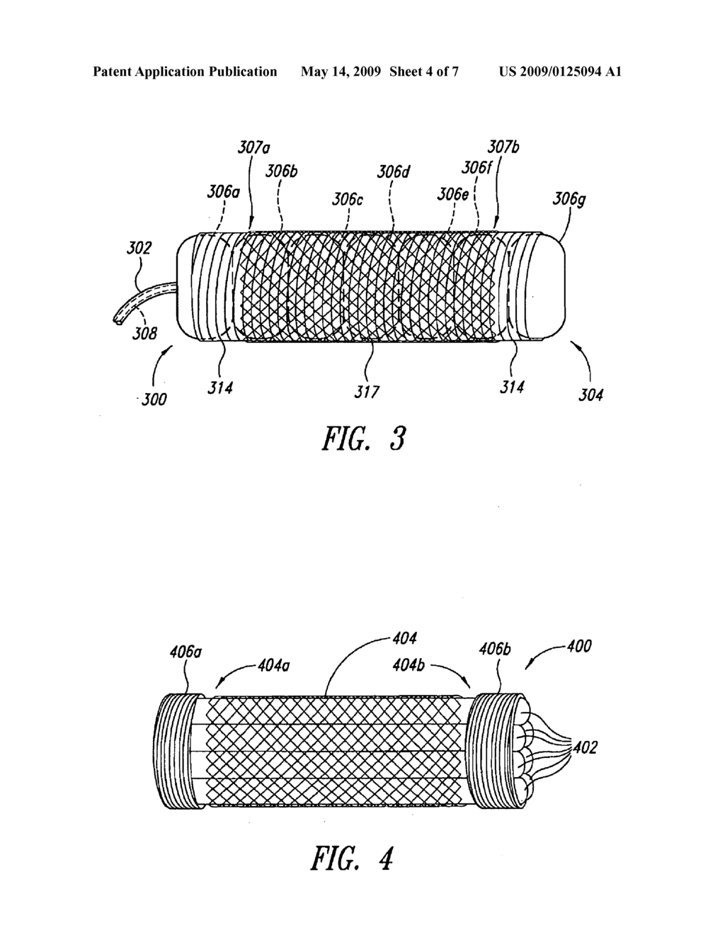 SHEATH FOR INTRAVASCULAR INFLATABLE STRUCTURES, FOR EXAMPLE TO EXPAND STENTS - diagram, schematic, and image 05