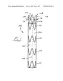 Stent Graft With Pins diagram and image