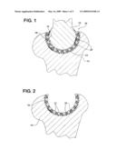 ARTIFICIAL KNEE IMPLANT INCLUDING LIQUID BALLAST SUPPORTING / ROTATING SURFACES AND INCORPORATING FLEXIBLE MULTI-MATERIAL AND NATURAL LUBRICANT RETAINING MATRIX APPLIED TO A JOINT SURFACE diagram and image