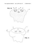ARTIFICIAL KNEE IMPLANT INCLUDING LIQUID BALLAST SUPPORTING / ROTATING SURFACES AND INCORPORATING FLEXIBLE MULTI-MATERIAL AND NATURAL LUBRICANT RETAINING MATRIX APPLIED TO A JOINT SURFACE diagram and image
