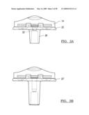 KNEE JOINT PROSTHESIS SYSTEM AND METHOD FOR IMPLANTATION diagram and image