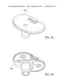 KNEE JOINT PROSTHESIS SYSTEM AND METHOD FOR IMPLANTATION diagram and image