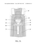 KNEE JOINT PROSTHESIS SYSTEM AND METHOD FOR IMPLANTATION diagram and image