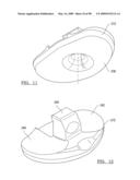 KNEE JOINT PROSTHESIS SYSTEM AND METHOD FOR IMPLANTATION diagram and image