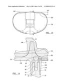 KNEE JOINT PROSTHESIS SYSTEM AND METHOD FOR IMPLANTATION diagram and image