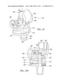 KNEE JOINT PROSTHESIS SYSTEM AND METHOD FOR IMPLANTATION diagram and image