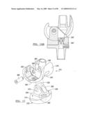 KNEE JOINT PROSTHESIS SYSTEM AND METHOD FOR IMPLANTATION diagram and image